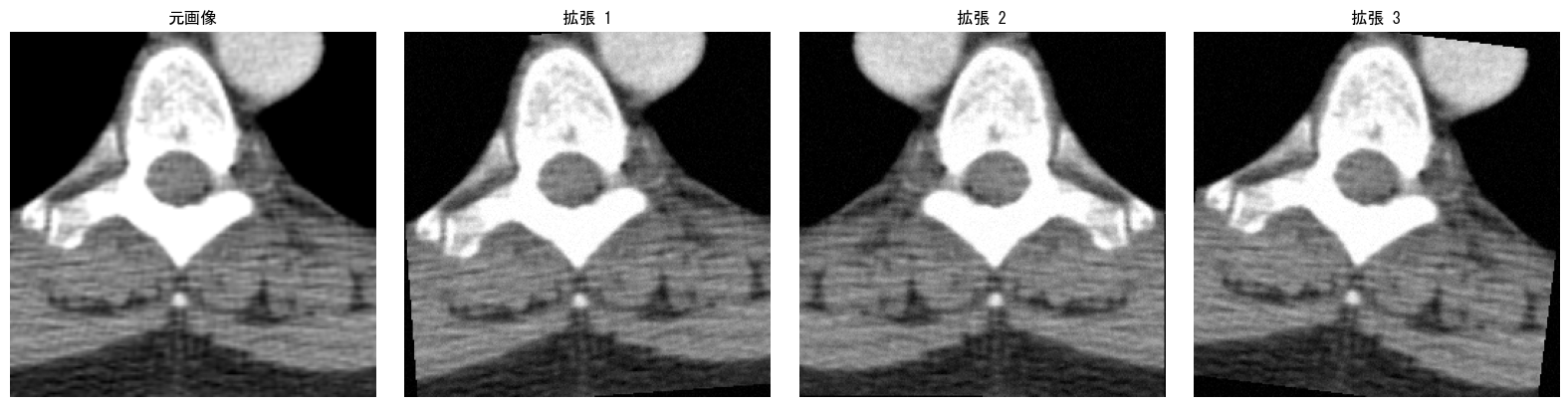 データ拡張の適用例。元画像と拡張1〜3の比較